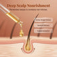 🔥2026 Hot Sale 50% OFF✨⚡ 50K+ SOLD! 🎁Ginger Anti-Hair Loss Treatment for Hair Growth