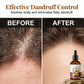 🔥2026 Hot Sale 50% OFF✨⚡ 50K+ SOLD! 🎁Ginger Anti-Hair Loss Treatment for Hair Growth