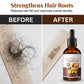 🔥2026 Hot Sale 50% OFF✨⚡ 50K+ SOLD! 🎁Ginger Anti-Hair Loss Treatment for Hair Growth