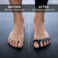🎁Buy 1 Get 1 Free🔥Hot Sale🔥Reusable & Washable Foot Alignment Correctors