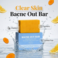🛁💥 Body Acne Soap For Clearer Skin – Charcoal & Tea Tree Oil, Deep Cleans Pores, Fights Back & Chest Acne, Unclogs Pores. Gentle For Daily Use! 🧼✨🌿